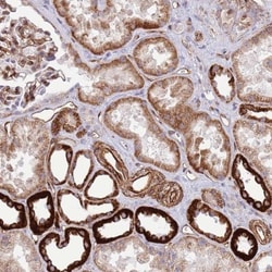NEK3 Antibody, Novus Biologicals 0.1mL; Unlabeled:Antibodies, Polyclonal